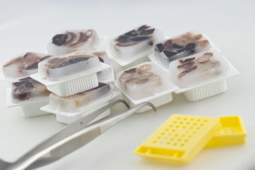 提供组织石蜡包埋/OCT包埋技术服务(图1)