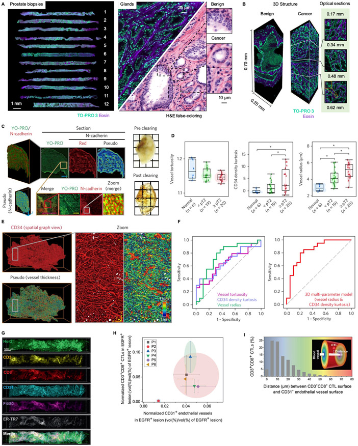 非破坏性3D病理技术:肿瘤诊断与精准医疗的新前沿数字病理技术(图3) 640 (1).png