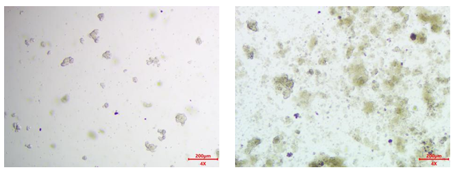 胃癌类器官培养基试剂盒( JFKR-GC-100-KIT/ JFKR-GC-500-KIT)(图1) 1742356829273.png