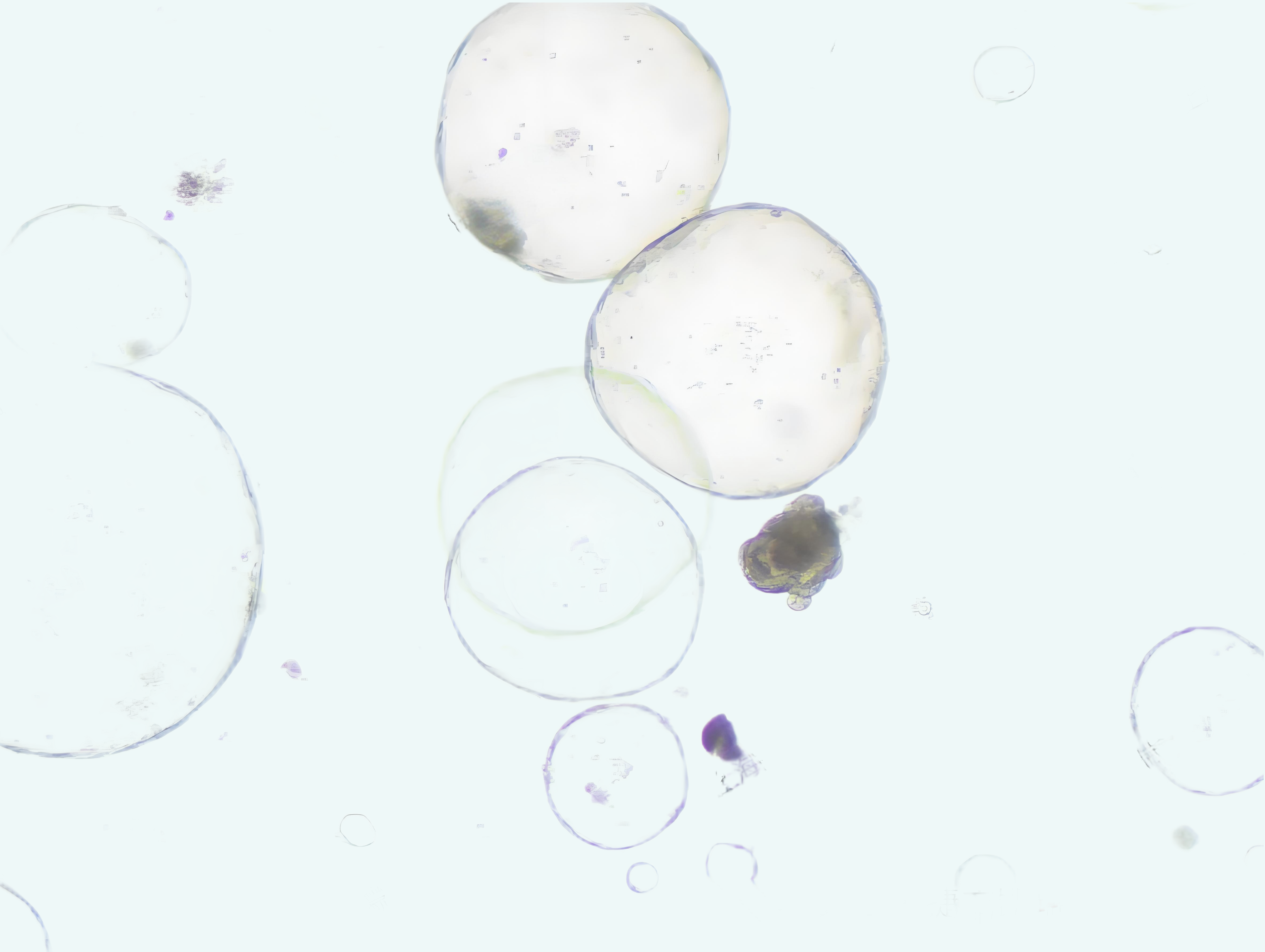 小鼠小肠类器官培养体系的优化:高/低出芽培养基的应用与选择策略(图2) 2222.png