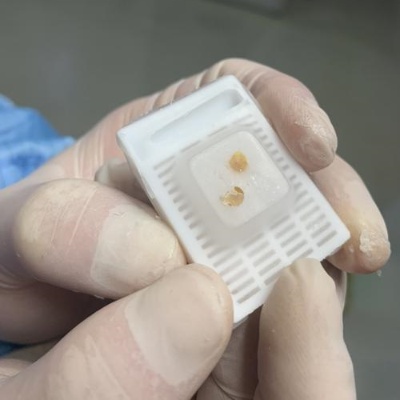 提供组织石蜡包埋/OCT包埋技术服务(图2)