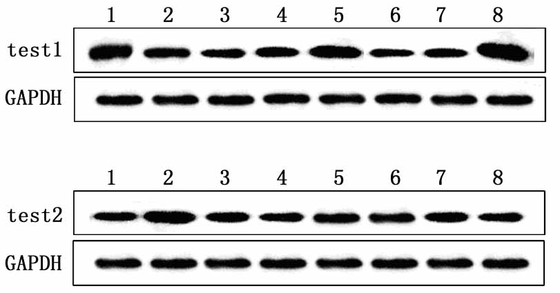 western-blot服务结果示例.jpg western-blot服务结果示例.jpg
