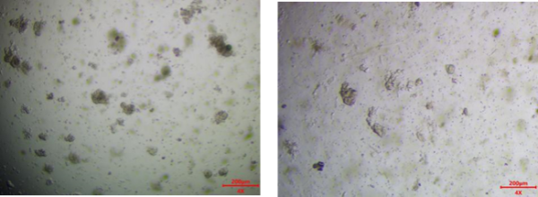 肝实质细胞癌类器官培养基试剂盒( JFKR-HCC-100-KIT/ JFKR-HCC-500-KIT)(图1) 人脑胶质瘤类器官培养基试剂盒(JFKR-GBM-100-Kit/JFKR-GBM-500-Kit)(图1)
