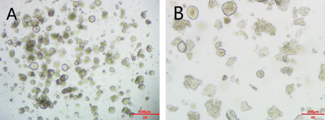 肝实质细胞癌类器官培养基试剂盒( JFKR-HCC-100-KIT/ JFKR-HCC-500-KIT)(图3) 人正常肺类器官培养基试剂盒(JFKR-NL -100-KIT/JFKR-NL -500-KIT)(图3)