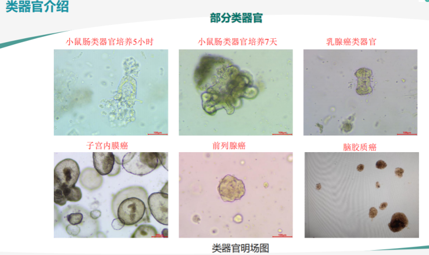 胃癌类器官培养基(JFKR-CRC-100/JFKR-CRC-500)(图2) 胃癌类器官培养基(JFKR-CRC-100/JFKR-CRC-500)(图2)