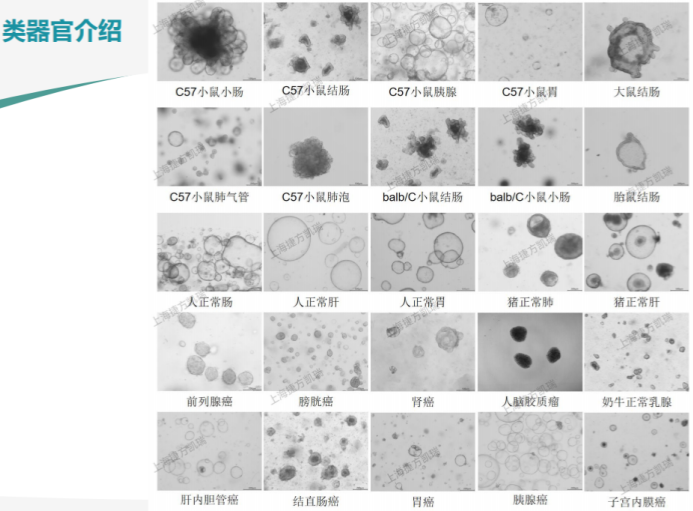 胃癌类器官培养基(JFKR-CRC-100/JFKR-CRC-500)(图3) 胃癌类器官培养基(JFKR-CRC-100/JFKR-CRC-500)(图3)