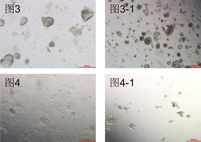 胃癌类器官培养基(JFKR-CRC-100/JFKR-CRC-500)(图7)