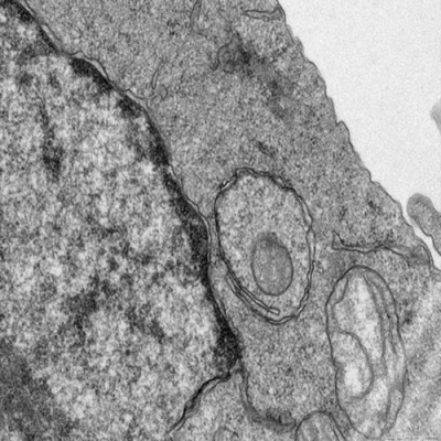 提供透射电镜（TEM）实验服务