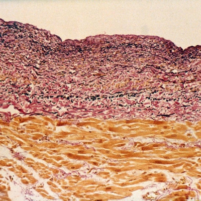 EVG染色（弹力纤维）