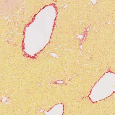 天狼猩红染色（胶原纤维定性）