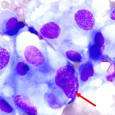 吉姆萨染色（嗜铬细胞）