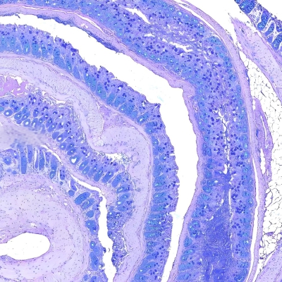 AB-PAS染色(中性粘液和糖原)