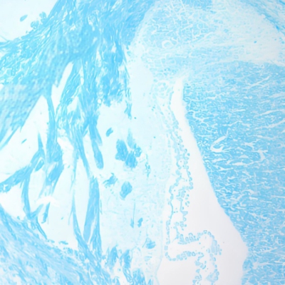 LFB染色（髓鞘）