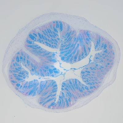 阿利新蓝染色（酸性粘液）