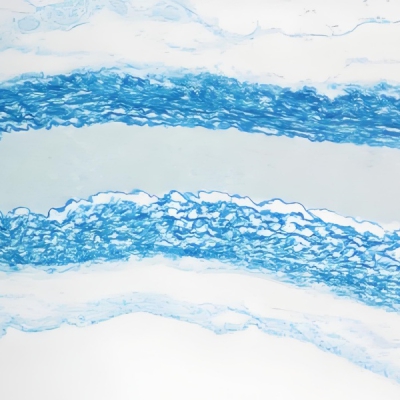 维多利亚蓝染色