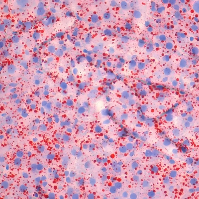 油红O染色（脂滴）