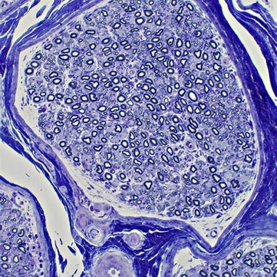 甲苯胺蓝染色(肥大细胞)