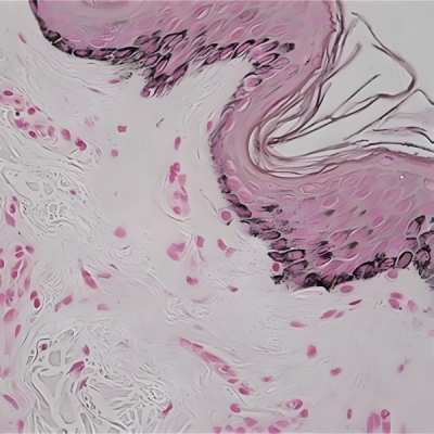 黑色素染色 (Masson Fontana)