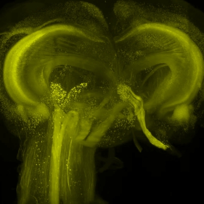 <strong>透视大脑奥秘：LifeCanvas 小鼠</strong>