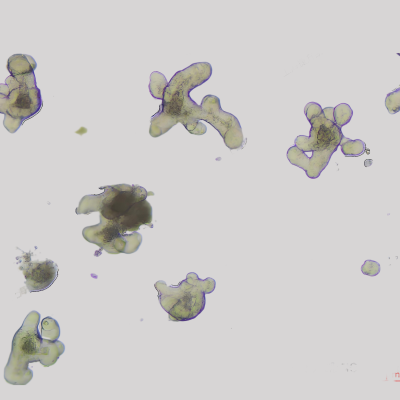 <strong>小鼠小肠类器官培养体系的优化：高/低出芽</strong>