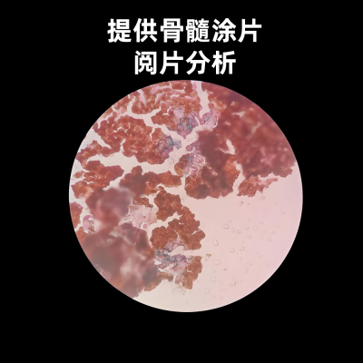 提供骨髓涂片制片/阅片分析技术服务