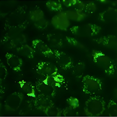 DHE/ROS染色（活性氧染色）