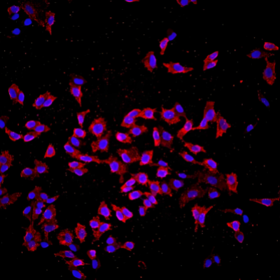 BrdU染色（细胞增殖检测）