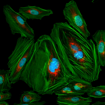 鬼笔环肽染色(细胞骨架）